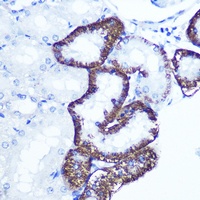 Anti-EXTL3 Antibody
