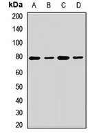 GFAT Rabbit Polyclonal Antibody