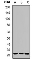 GPx-7 Rabbit Polyclonal Antibody