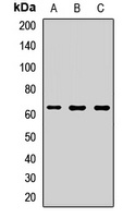 ME1 Rabbit Polyclonal Antibody