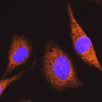 Anti-MUT Antibody
