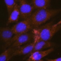 OSBP antibody