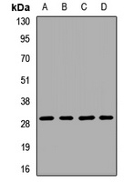 PGAM1 Antibody