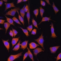 Anti-PMM2 Antibody