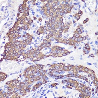 Anti-UBL3 Antibody