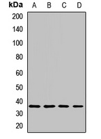 PP1 gamma Rabbit Polyclonal Antibody