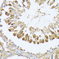 Anti-PSMA7 Antibody