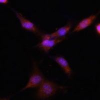 PSMA7 antibody