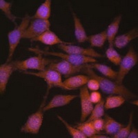 Anti-PSMB6 Antibody