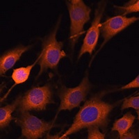 Anti-RNH1 Antibody