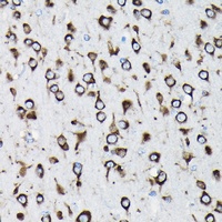 Anti-RPL23A Antibody