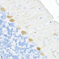 Anti-RPL19 Antibody