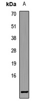 SRP9 Rabbit Polyclonal Antibody