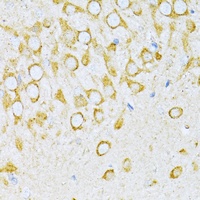 Anti-VARS Antibody