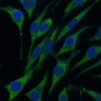 Anti-VARS Antibody