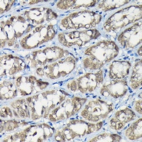 Anti-USP5 Antibody