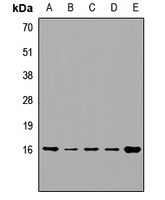 VAMP4 Rabbit Polyclonal Antibody