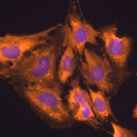 Anti-RPL23 Antibody