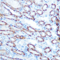 Anti-LONP1 Antibody