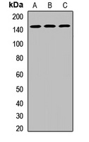DHX38 Rabbit Polyclonal Antibody