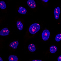 Anti-MYBBP1A Antibody