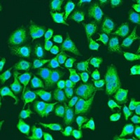 Anti-IGF2BP3 Antibody