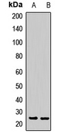 Rpp29 Rabbit Polyclonal Antibody