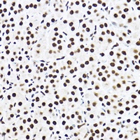 Anti-SAP61 Antibody