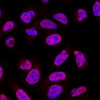 Anti-SAP61 Antibody