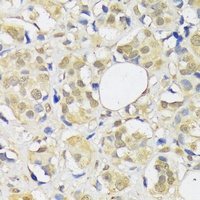 Anti-ADRM1 Antibody