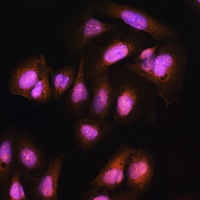Anti-ADRM1 Antibody