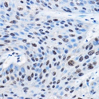 Anti-NUDT21 Antibody