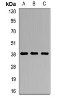 DMC1 Rabbit Polyclonal Antibody