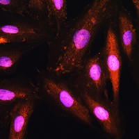Anti-KAP3 Antibody