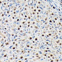 Anti-GTPBP4 Antibody