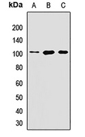 LIV-1 Rabbit Polyclonal Antibody