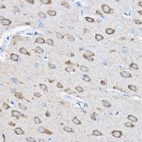 Anti-PTPN23 Antibody