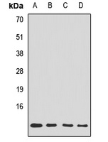 Tim10 Rabbit Polyclonal Antibody