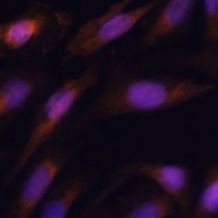 Anti-E2 EPF Antibody