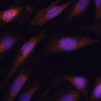 UBE2S antibody