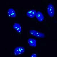 Anti-NOP58 Antibody