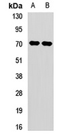 CROT Antibody