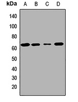 MKS1 Rabbit Polyclonal Antibody
