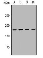 UGGT1 Rabbit Polyclonal Antibody