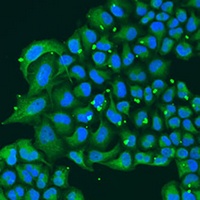 Anti-ATPIF1 Antibody