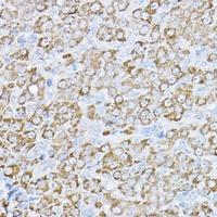 Anti-UBE2F Antibody