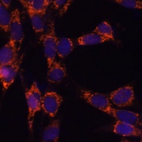 Anti-UBE2F Antibody