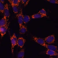 UBE2F antibody