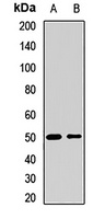 SESN3 Rabbit Polyclonal Antibody