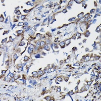 GSTK1 antibody